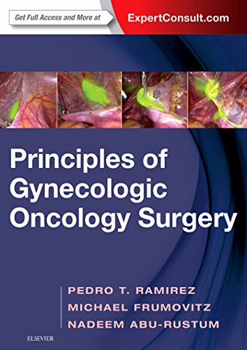 Principles Of Gynecologic Oncology Surgery (PDF Instant Download)