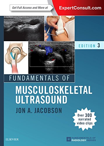 Fundamentals Of Musculoskeletal Ultrasound (PDF Instant Download)