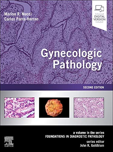 Gynecologic Pathology : A Volume In The Foundations In Diagnostic Pathology Series (PDF Instant Download)