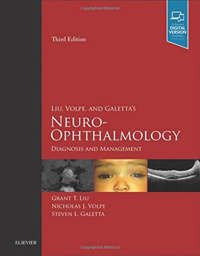 Neuro-Ophthalmology: Diagnosis And Management, Book With Dvd-Rom (PDF Instant Download)