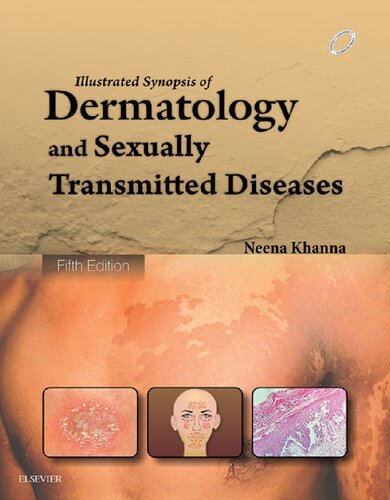 Illustrated Synopsis of Dermatology & Sexually Transmitted Diseases (PDF Instant Download)