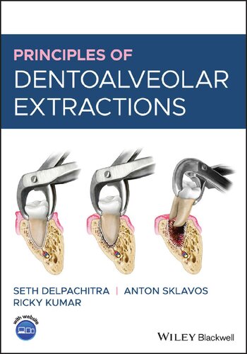 Principles of Dentoalveolar Extractions (PDF Instant Download)