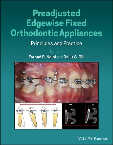 Preadjusted Edgewise Fixed Orthodontic Appliances: Principles and Practice (PDF Instant Download)