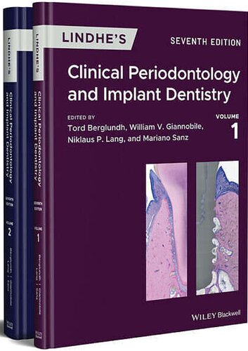 Lindhe's Clinical Periodontology and Implant Dentistry. Volume I-II (PDF Instant Download)
