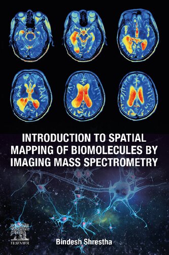 Introduction to Spatial Mapping of Biomolecules by Imaging Mass Spectrometry (PDF Instant Download)