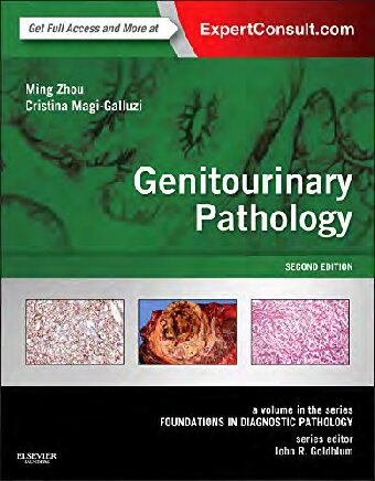 Genitourinary Pathology (PDF Instant Download)