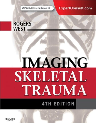 Imaging skeletal trauma (PDF Instant Download)