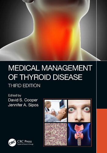 Medical Management of Thyroid Disease (PDF Instant Download)