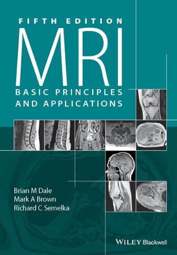 MRI Basic Principles and Applications (PDF Instant Download)