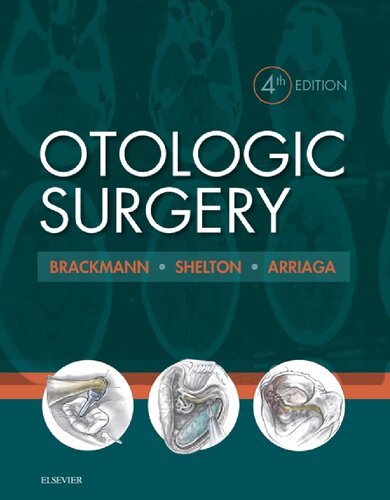 Otologic Surgery (PDF Instant Download)