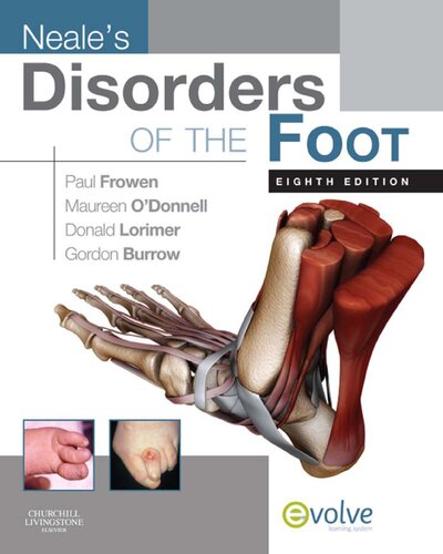 Disorders of the Foot (PDF Instant Download) Disorders of the Foot (PDF Instant Download)