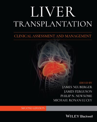 Liver Transplantation: Clinical Assessment and Management (PDF Instant Download)