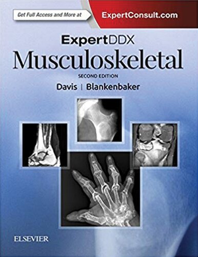 ExpertDDX: Musculoskeletal (PDF Instant Download)