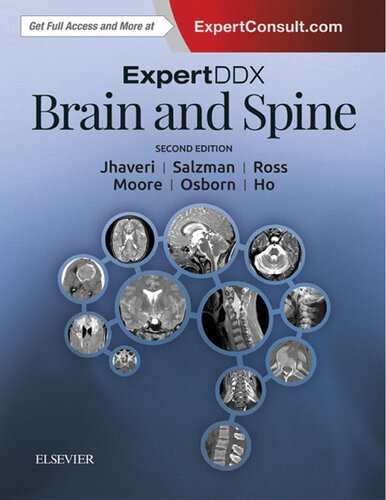 ExpertDDx: Brain and Spine (PDF Instant Download)