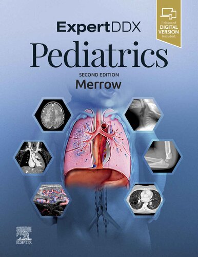 EXPERTddx: Pediatrics (PDF Instant Download)