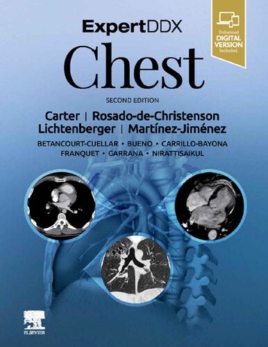 ExpertDDx: Chest (PDF Instant Download)