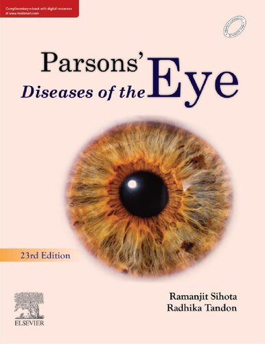 Parsons Diseases of the Eye (PDF Instant Download)