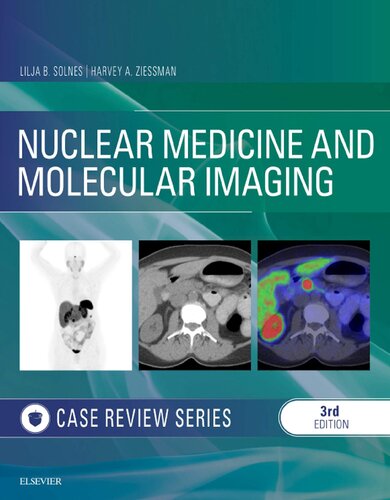 Nuclear Medicine and Molecular Imaging: Case Review Series (PDF Instant Download)