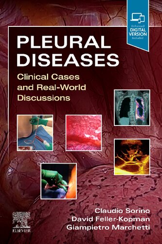 Pleural Diseases: Clinical Cases and Real-World Discussions (PDF Instant Download)