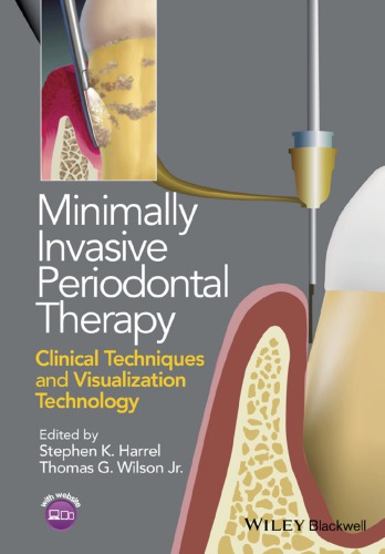 Minimally Invasive Periodontal Therapy: Clinical Techniques and Visualization Technology (PDF Instant Download)