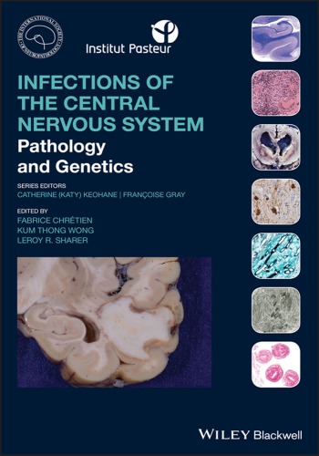 Infections of the Central Nervous System: Pathology and Genetics (PDF Instant Download)
