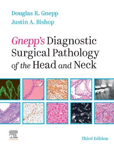 Gnepp's Diagnostic Surgical Pathology of the Head and Neck (PDF Instant Download)