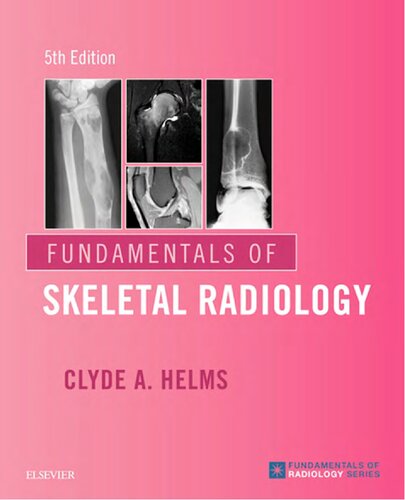 Fundamentals of Skeletal Radiology (PDF Instant Download)