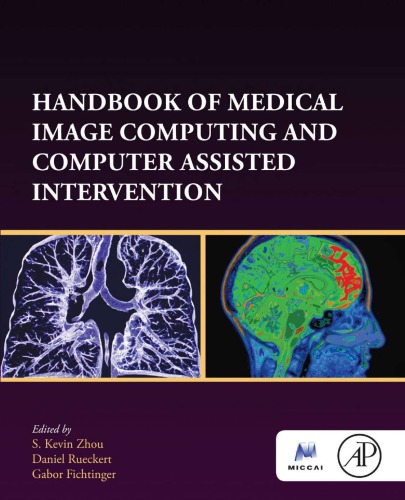 Handbook of medical image computing and computer assisted intervention (PDF Instant Download)