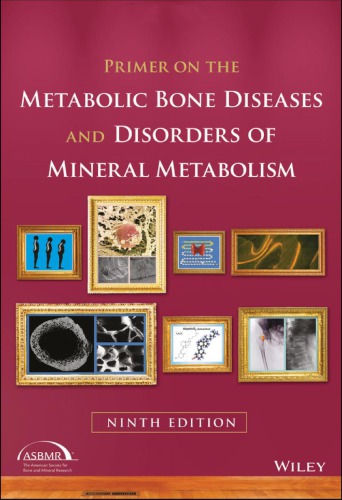 Primer on the metabolic bone diseases and disorders of mineral metabolism (PDF Instant Download)