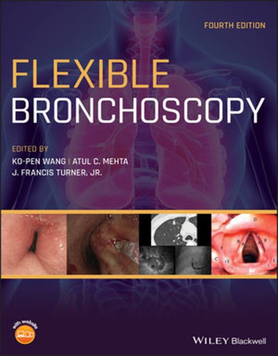 Flexible Bronchoscopy (PDF Instant Download)