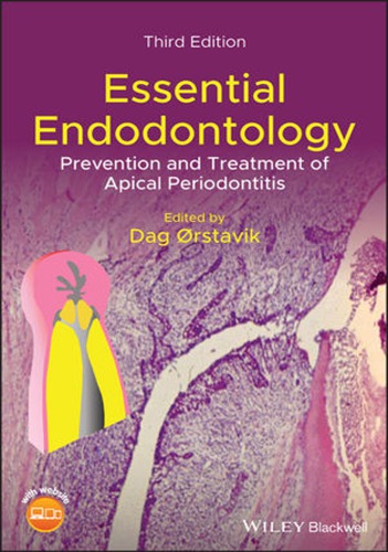 Essential endodontology prevention and treatment of apical periodontitis (PDF Instant Download)