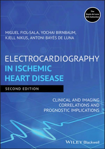 Electrocardiography in ischemic heart disease clinical and imaging correlations and prognostic implications (PDF Instant Download)