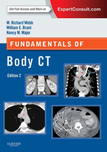 Fundamentals of body CT (PDF Instant Download)