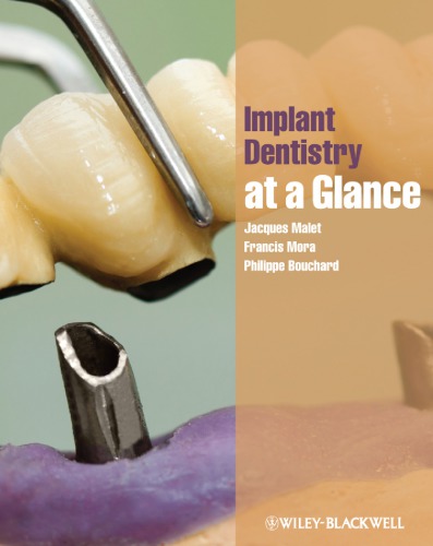 Implant dentistry at a glance (PDF Instant Download)