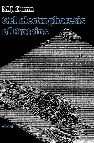 Gel Electrophoresis of Proteins (PDF Instant Download)