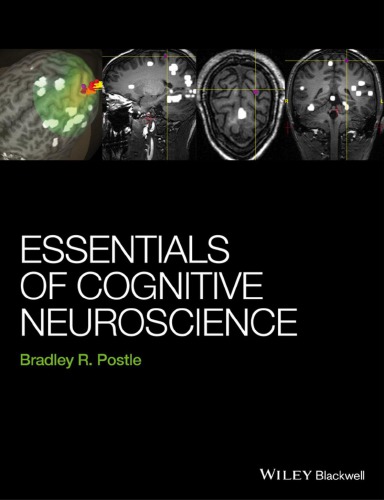 Essentials of cognitive neuroscience (PDF Instant Download)