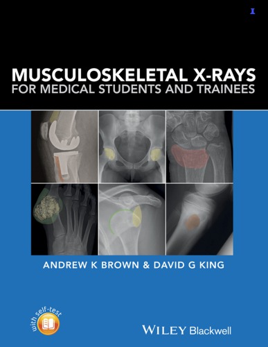Musculoskeletal X-rays for medical students and trainees (PDF Instant Download)