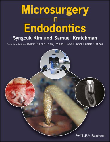 Microsurgery in endodontics (PDF Instant Download)