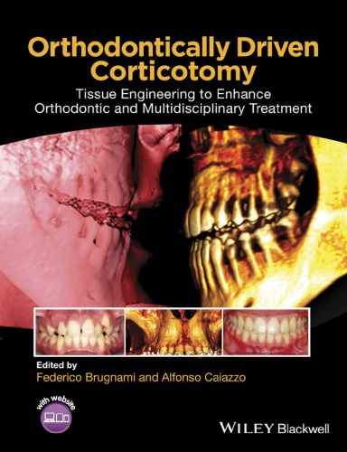Orthodontically driven corticotomy: tissue engineering to enhance orthodontic and multidisciplinary treatment (PDF Instant Download)