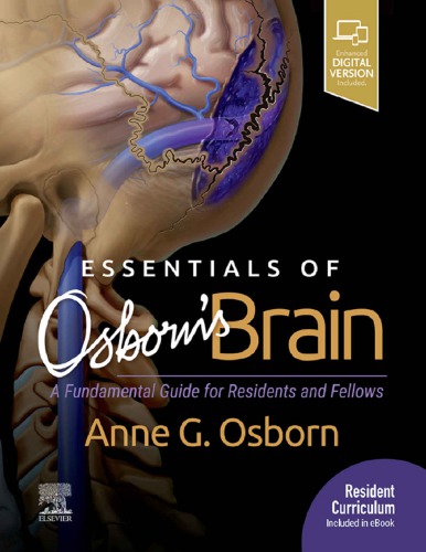 Essentials of Osborn’s Brain: A Fundamental Guide for Residents and Fellows (PDF Instant Download)