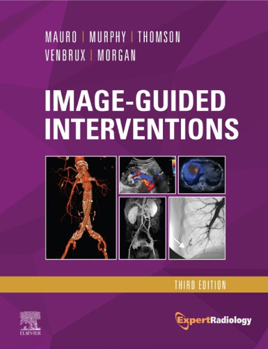 Image-Guided Interventions (Expert Radiology Series) (PDF Instant Download)