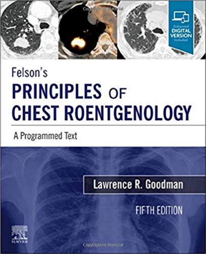 Felson’s Principles of Chest Roentgenology: A Programmed Text (PDF Instant Download)