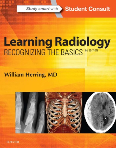 Learning radiology: recognizing the basics (PDF Instant Download)