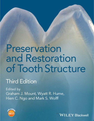 Preservation and Restoration of Tooth Structure (PDF Instant Download)