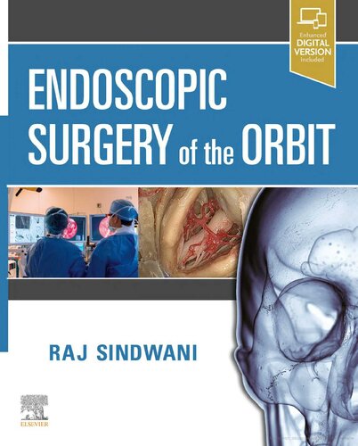Endoscopic Surgery of the Orbit (PDF Instant Download)