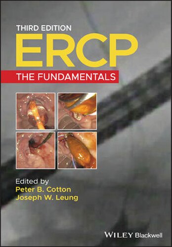 Ercp: The Fundamentals (PDF Instant Download)
