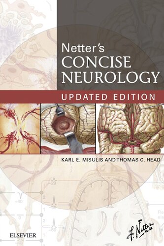 Netter's Concise Neurology Updated Edition (Netter Clinical Science) (PDF Instant Download)