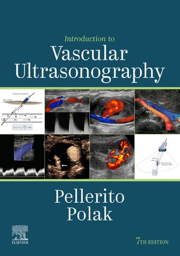 Introduction to Vascular Ultrasonography (PDF Instant Download)