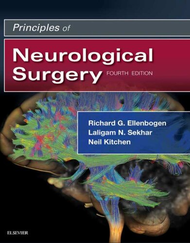 Principles of Neurological Surgery, 4ED (PDF Instant Download)