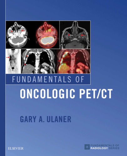 Fundamentals of Oncologic PET/CT (PDF Instant Download)